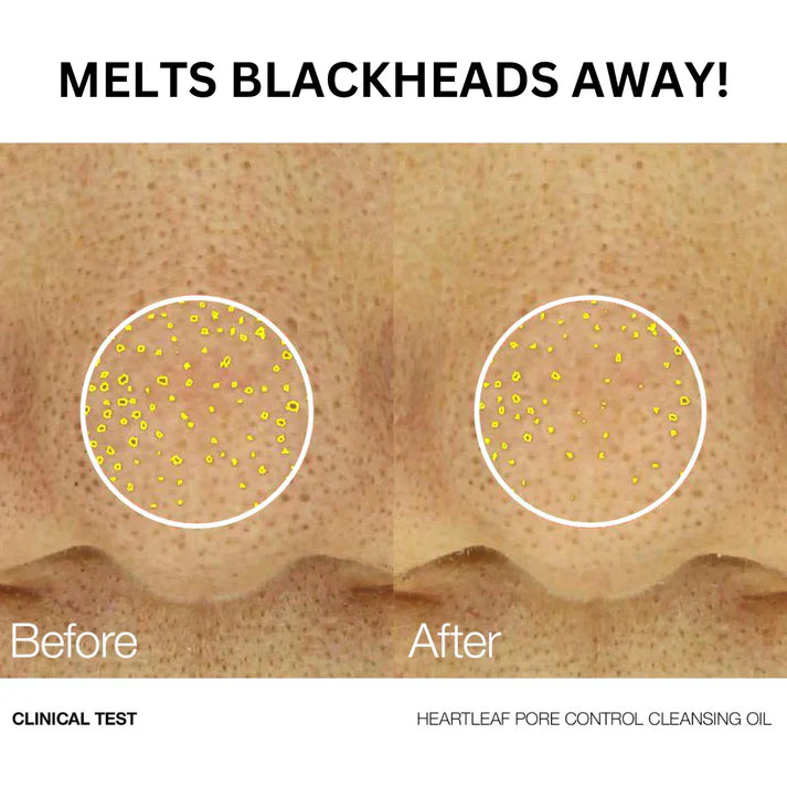 Anua - Heartleaf Pore Control Cleansing Oil - 200ml