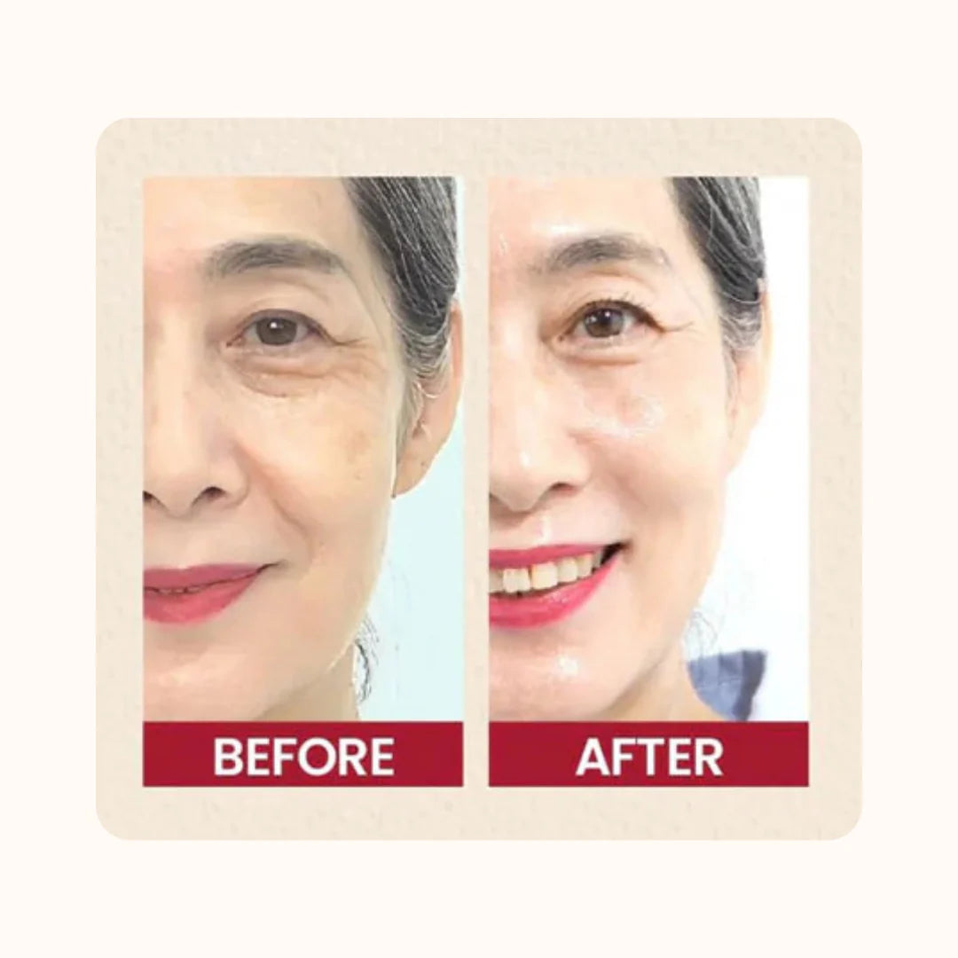 SEOUL 1988 Serum : Retinal Liposome 2% + Black Ginseng - KSECRET