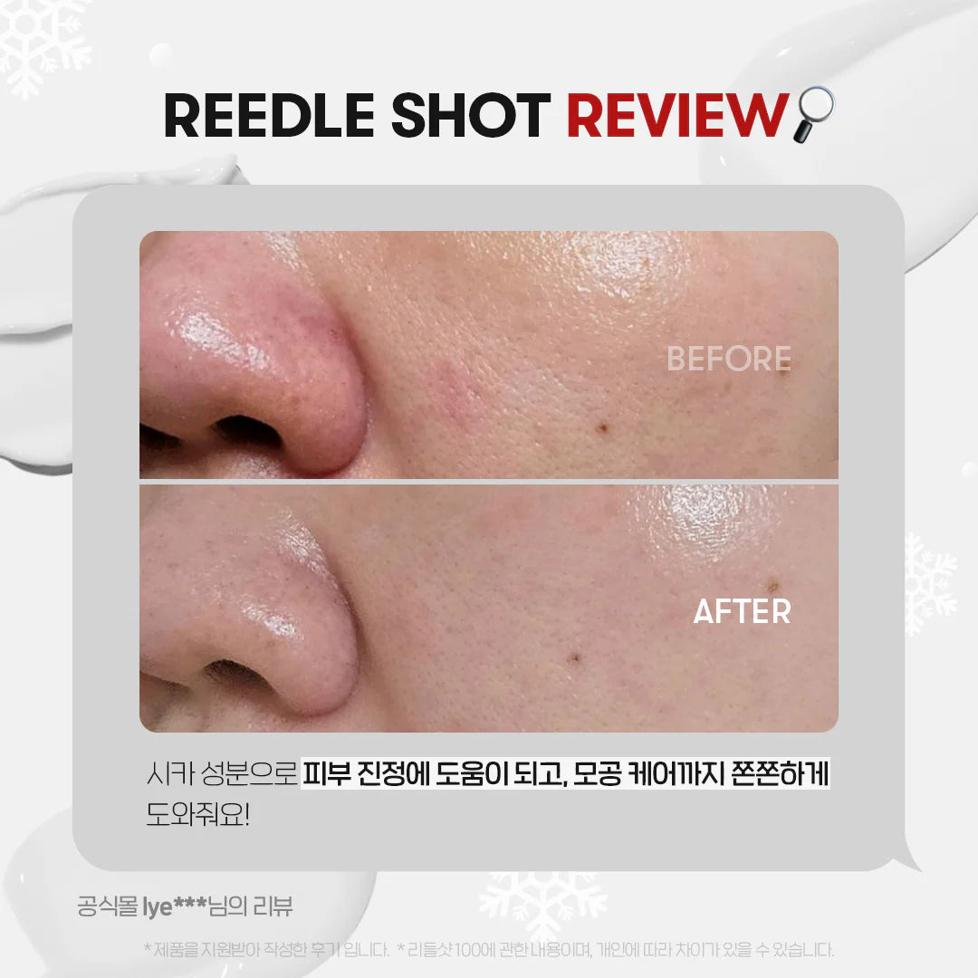 VT - Serum Reedle shot 100