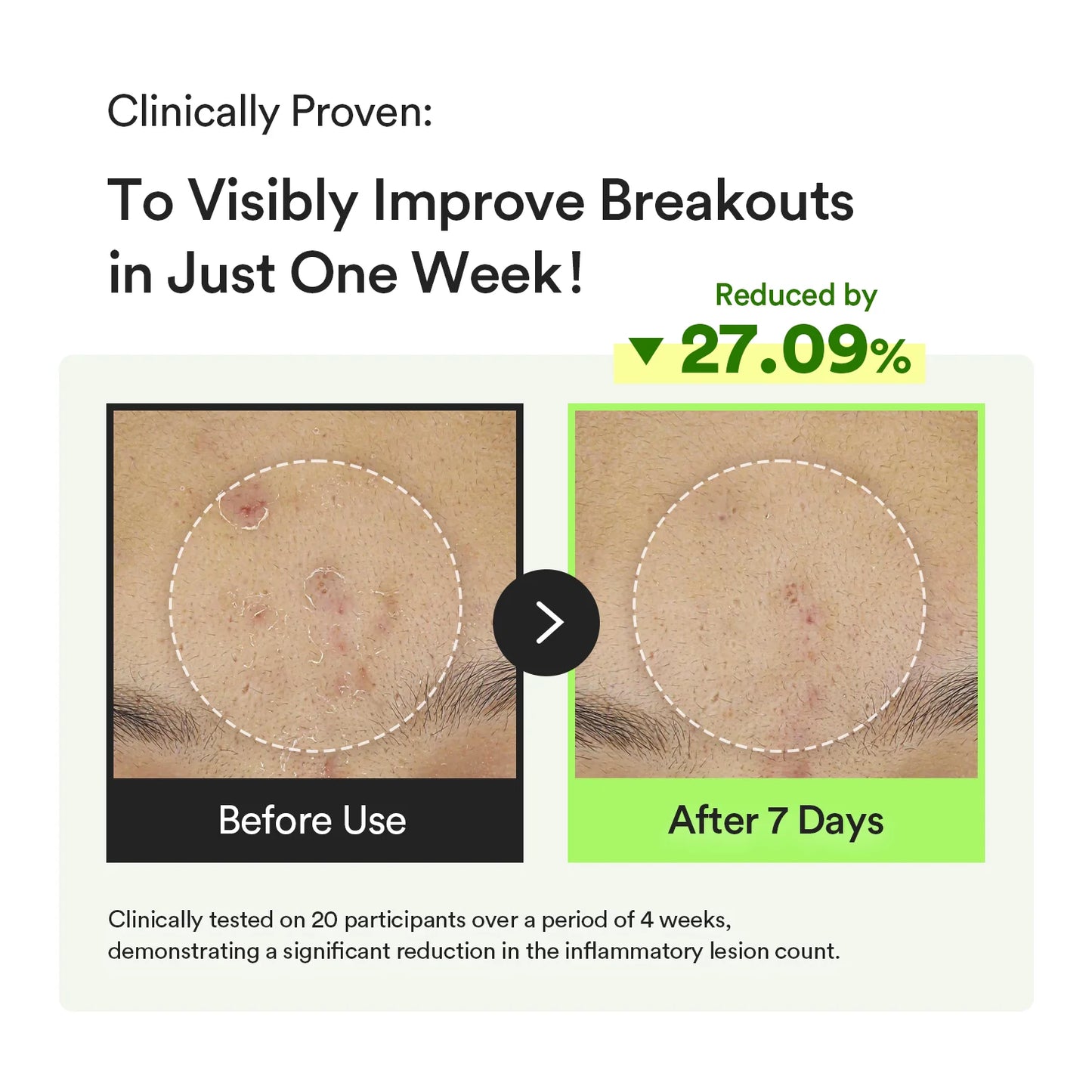 Abib - Heartleaf TECA capsule serum Calming drop 50ml