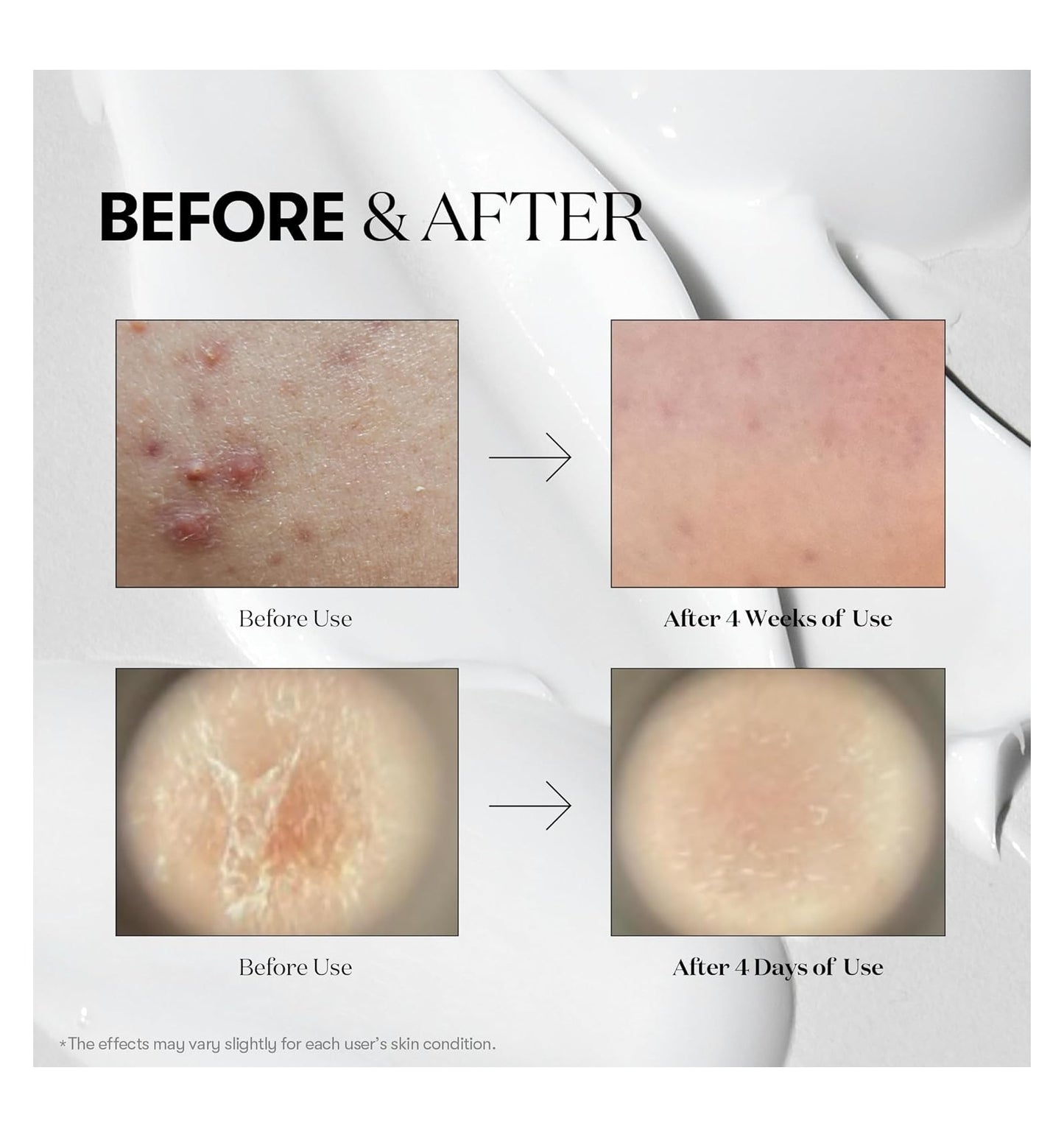 VT - Serum Reedle shot 100