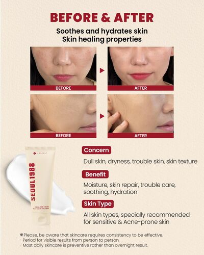 SEOUL 1988 Crema: Snail Mucin 93% + Rice -  Ksecret - 100ml